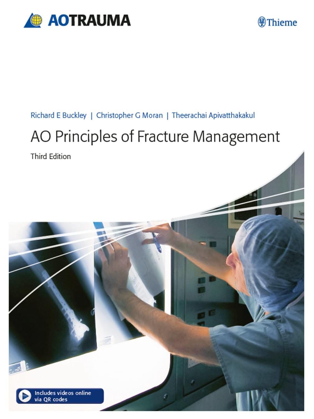 AO Principles of Fracture Management